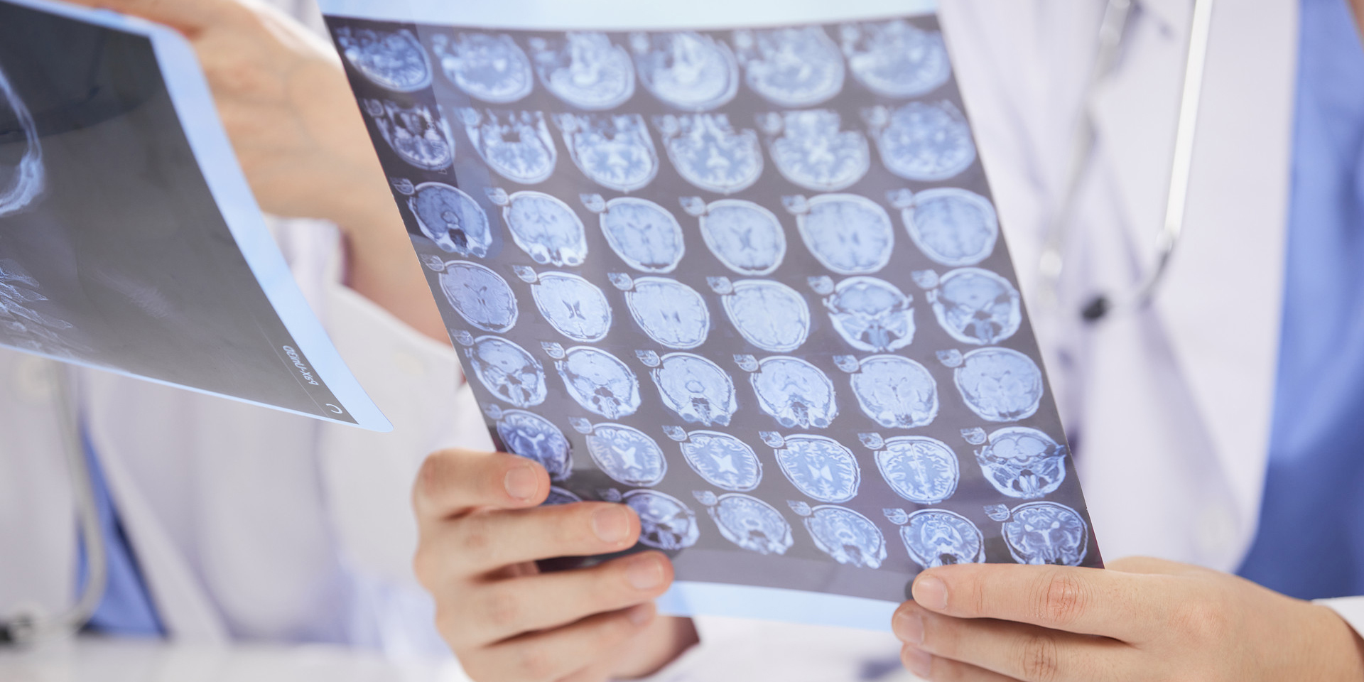  氧化铝打印介质吸附剂